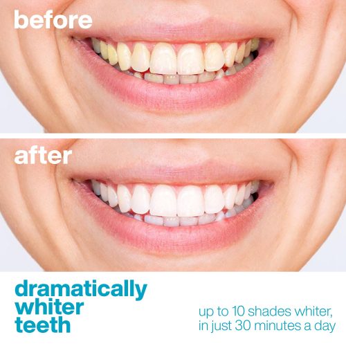 AquaSonic Whitening Strips 5